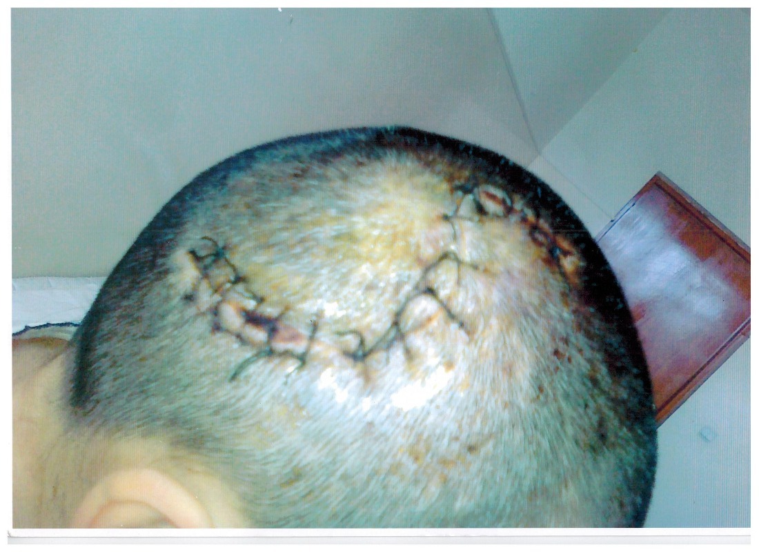 Timagova head injury.jpg