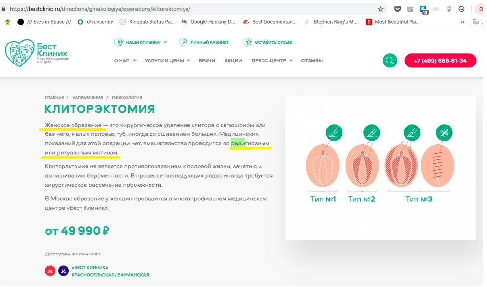 Доклад по теме Обрезание